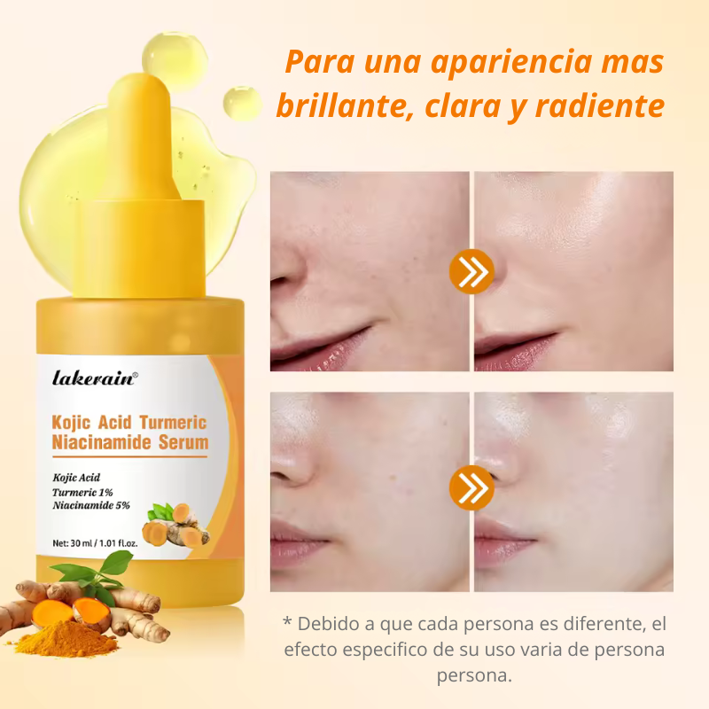 Serum de cúrcuma, ácido kójico y niacinamida (30ml)