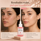 Serum con PDRN de salmon - hidratante y reafirmante (30 ml)