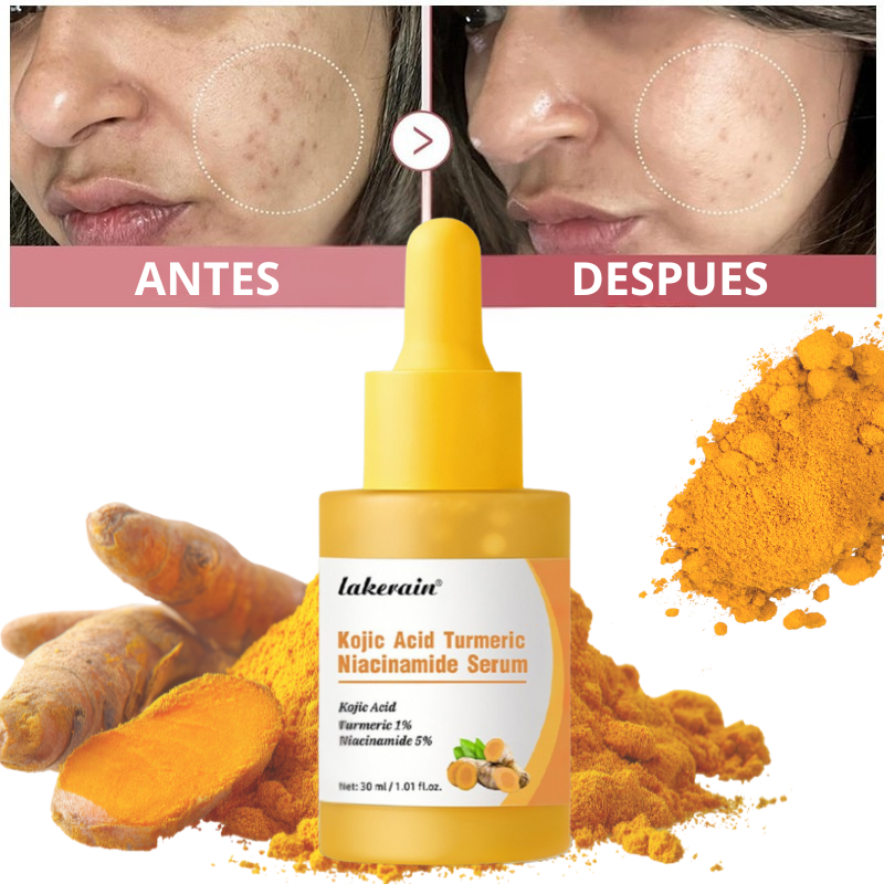 Serum de cúrcuma, ácido kójico y niacinamida (30ml)